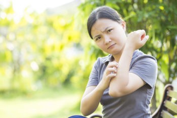 Woman with eczema scratching herself
