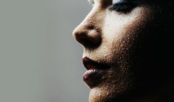 Prevent dry skin this winter