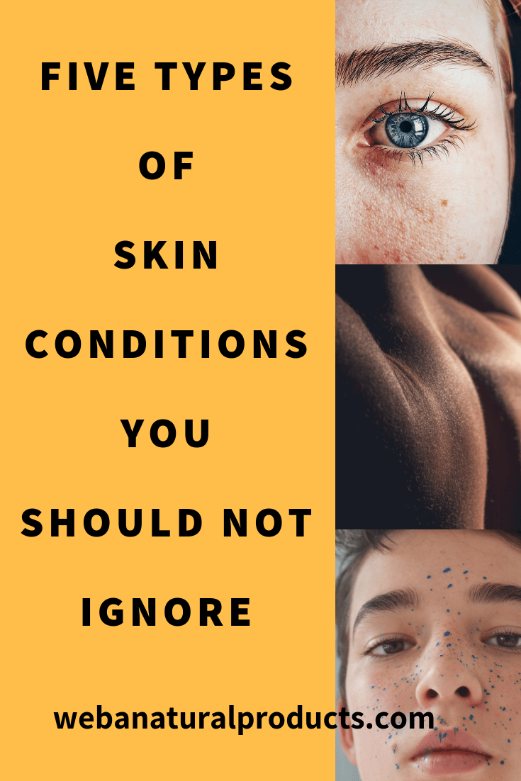five types of skin conditions you should not ignore blog post
